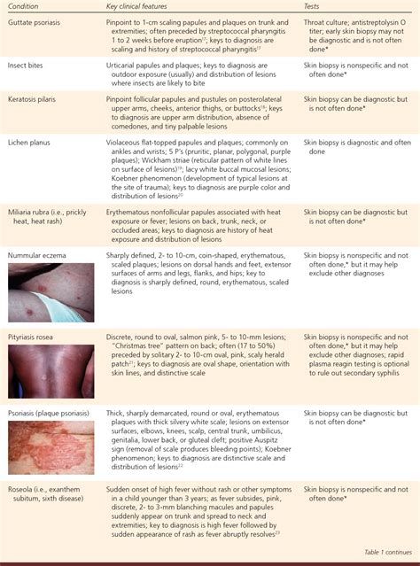 how to diagnose hives